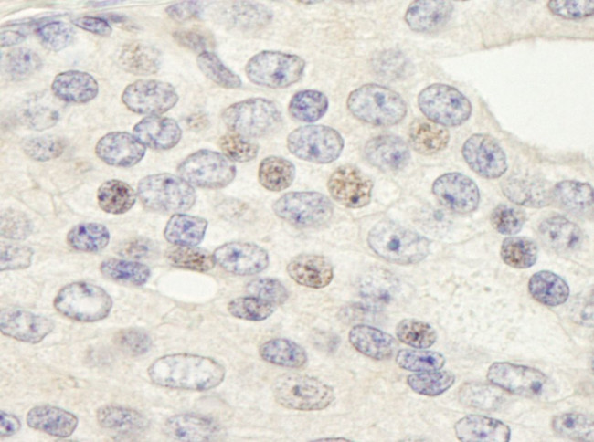 ZNF592 Antibody in Immunohistochemistry (IHC)