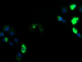 ZSCAN18 Antibody in Immunocytochemistry (ICC/IF)