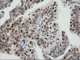 ZSCAN18 Antibody in Immunohistochemistry (Paraffin) (IHC (P))