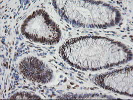 ZSCAN18 Antibody in Immunohistochemistry (Paraffin) (IHC (P))