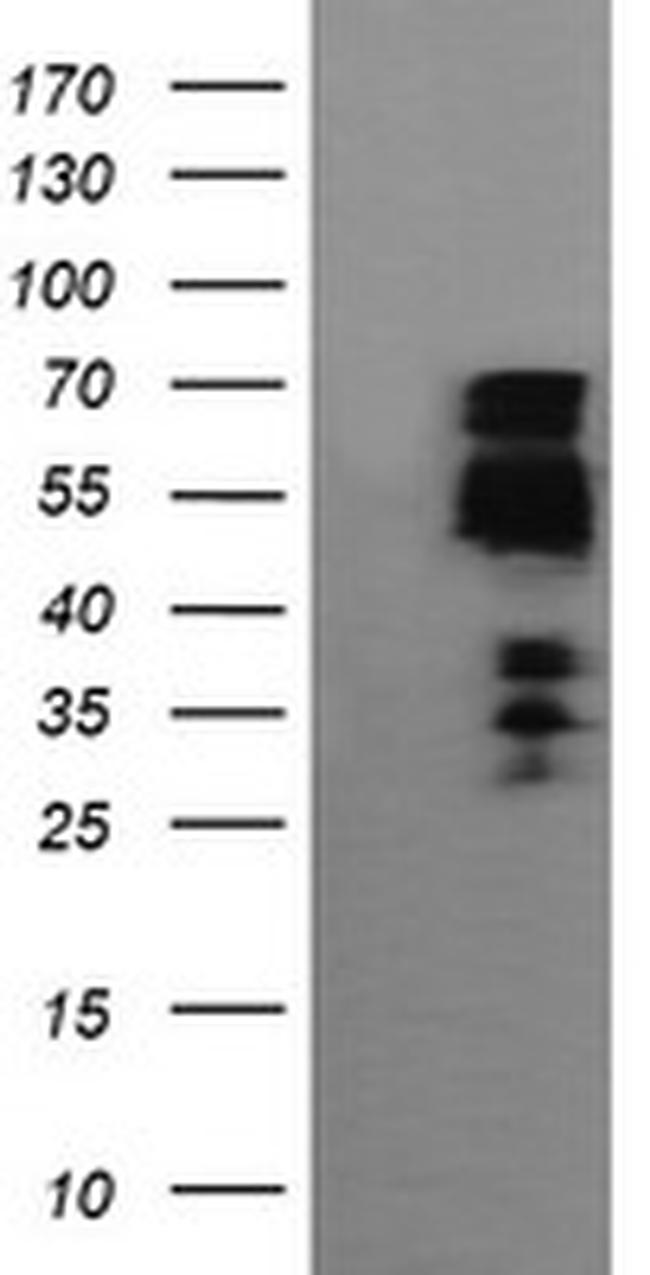 ZSCAN18 Antibody in Western Blot (WB)