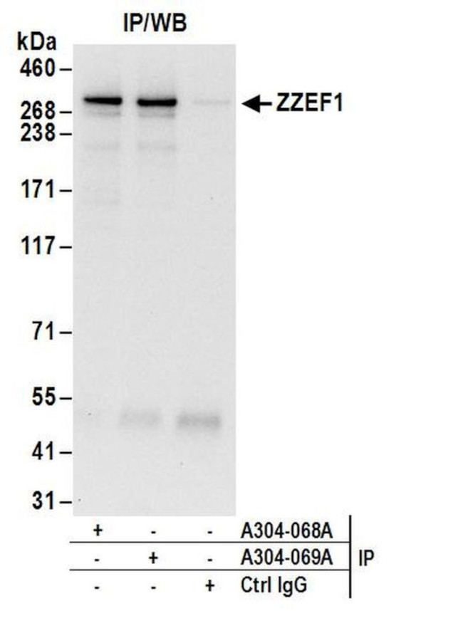 ZZEF1 Antibody in Immunoprecipitation (IP)