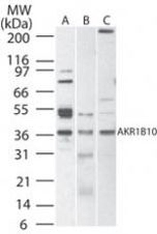 AKR1B10 Antibody in Western Blot (WB)