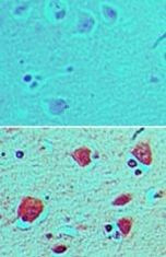 BST-1 Antibody in Immunohistochemistry (Paraffin) (IHC (P))