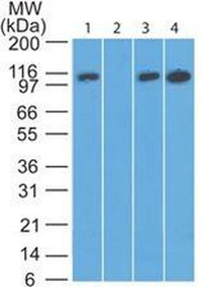 DAAM2 Antibody in Western Blot (WB)