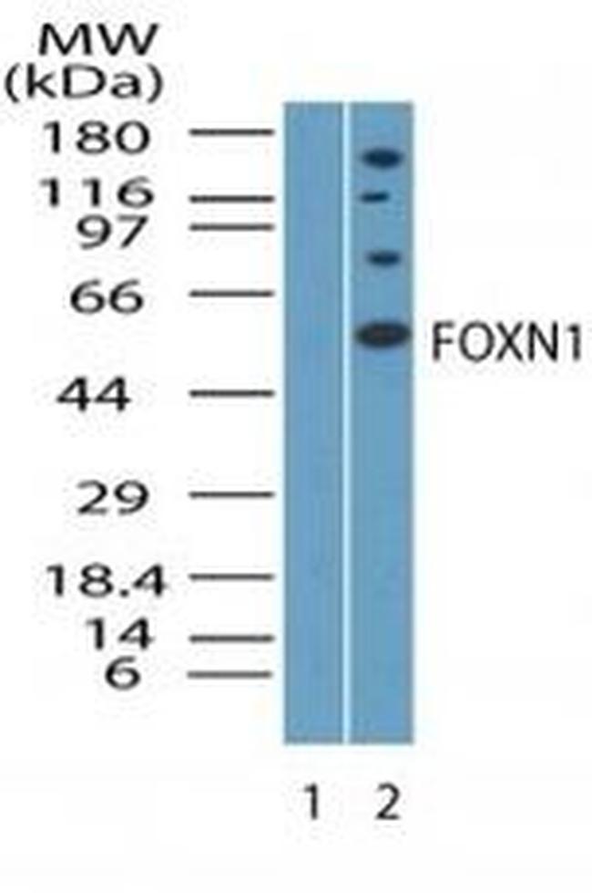 FOXN1 Antibody in Western Blot (WB)