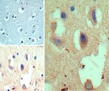 HES1 Antibody in Immunohistochemistry (Paraffin) (IHC (P))