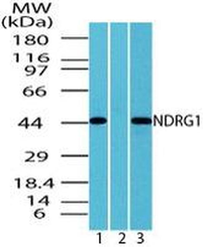 NDRG1 Antibody in Western Blot (WB)