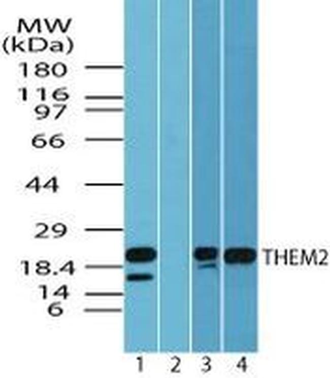 THEM2 Antibody in Western Blot (WB)