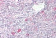 TLR2 Antibody in Immunohistochemistry (Paraffin) (IHC (P))