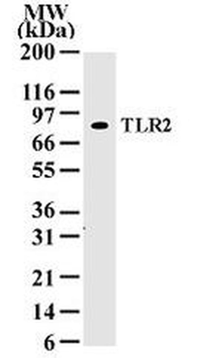 TLR2 Antibody in Western Blot (WB)