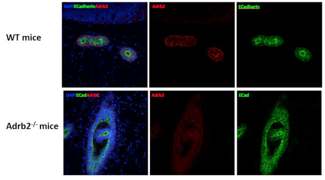 Donkey anti-Rabbit IgG (H+L) Highly Cross-Adsorbed, Alexa Fluor 