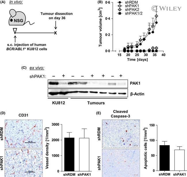 CD31 Antibody in Immunohistochemistry (IHC)