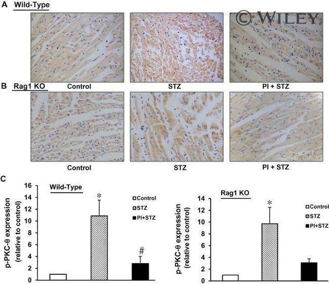 Phospho-PKC theta (Thr538) Antibody in Immunohistochemistry (Paraffin) (IHC (P))