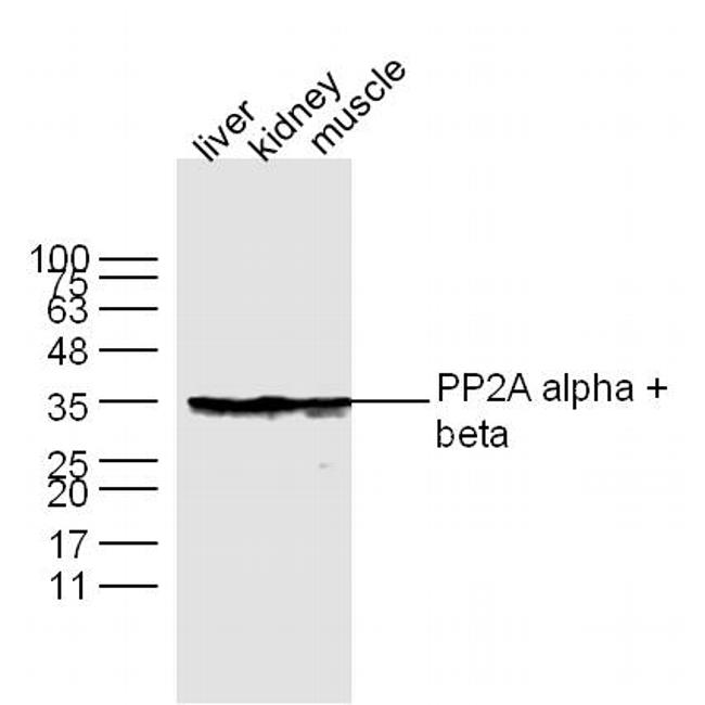 PP2A alpha/beta Antibody in Western Blot (WB)