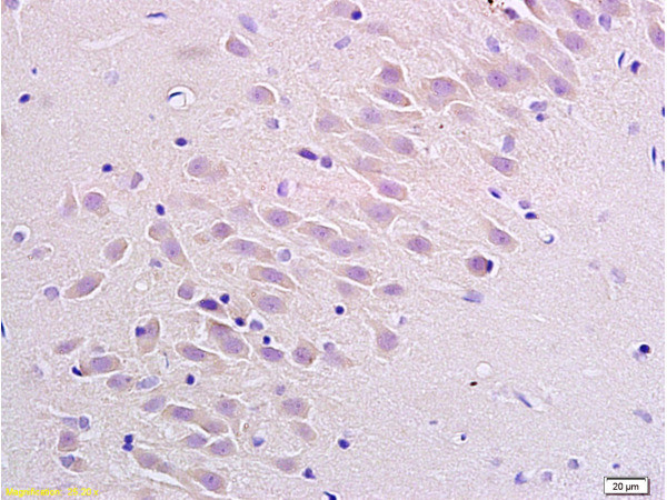 Neurokinin 1 Receptor Antibody in Immunohistochemistry (Paraffin) (IHC (P))