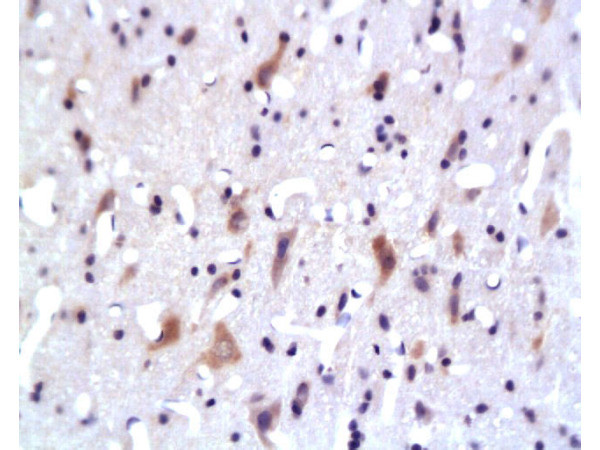 AKT1/3 Antibody in Immunohistochemistry (Paraffin) (IHC (P))