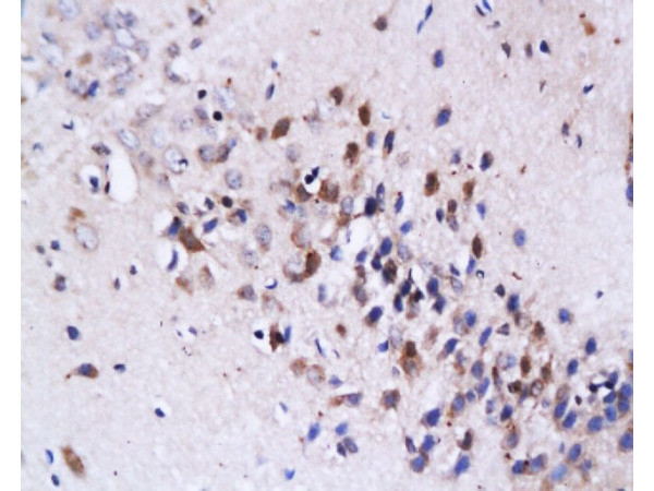 Fas Ligand Antibody in Immunohistochemistry (Paraffin) (IHC (P))