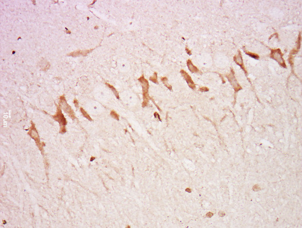 Neurofascin Antibody in Immunohistochemistry (Paraffin) (IHC (P))