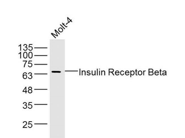 Insulin Receptor Beta Antibody in Western Blot (WB)