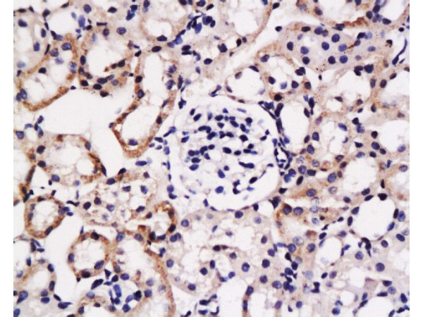 FGL2 Antibody in Immunohistochemistry (Paraffin) (IHC (P))