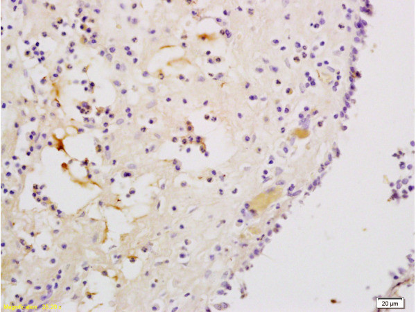 CXCR3 Antibody in Immunohistochemistry (Paraffin) (IHC (P))