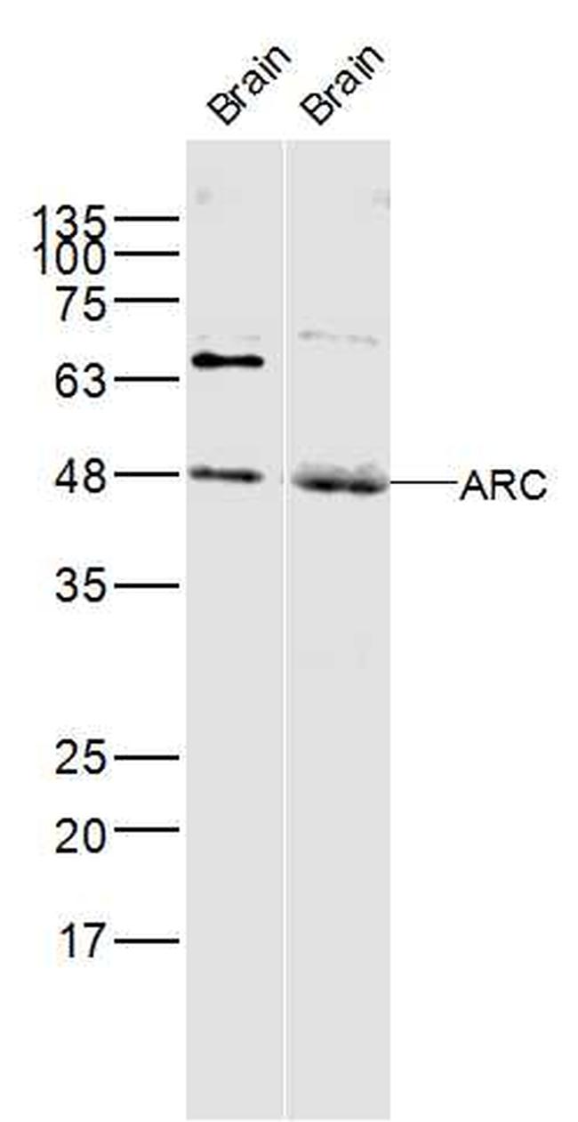 ARC/Arg3.1 Antibody in Western Blot (WB)