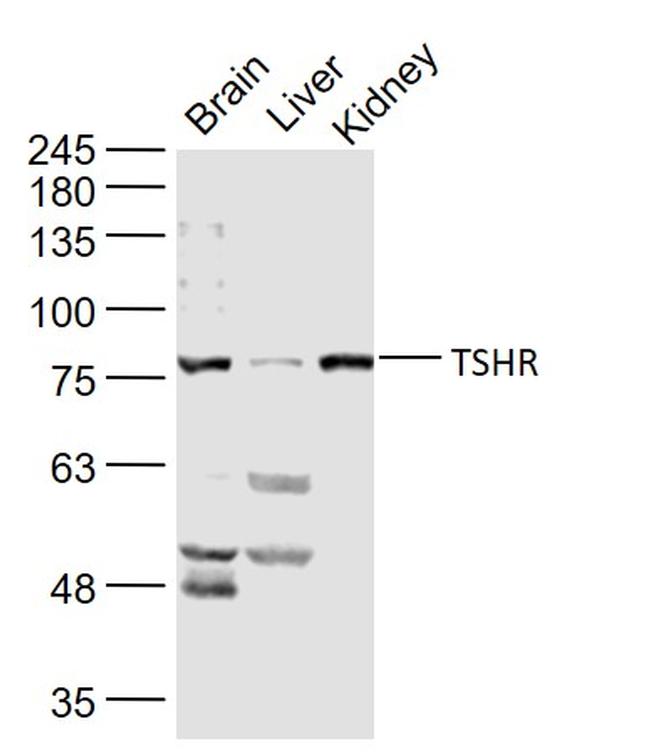 TSHR Antibody in Western Blot (WB)