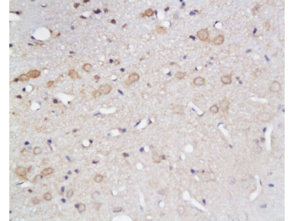 GLUT1 Antibody in Immunohistochemistry (Paraffin) (IHC (P))