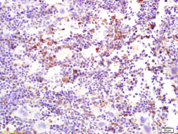 MERTK Antibody in Immunohistochemistry (Paraffin) (IHC (P))