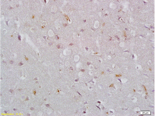 EpCAM Antibody in Immunohistochemistry (Paraffin) (IHC (P))