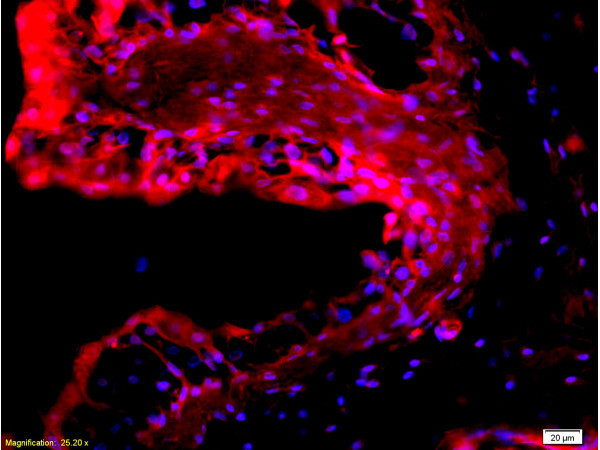 EpCAM Antibody in Immunohistochemistry (Paraffin) (IHC (P))