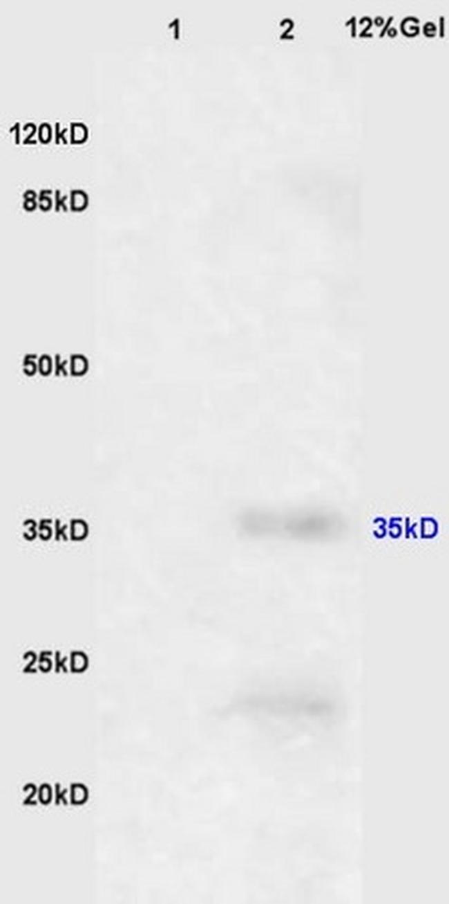 EpCAM Antibody in Western Blot (WB)