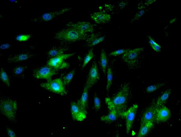 ICAM1 Antibody in Immunocytochemistry (ICC/IF)