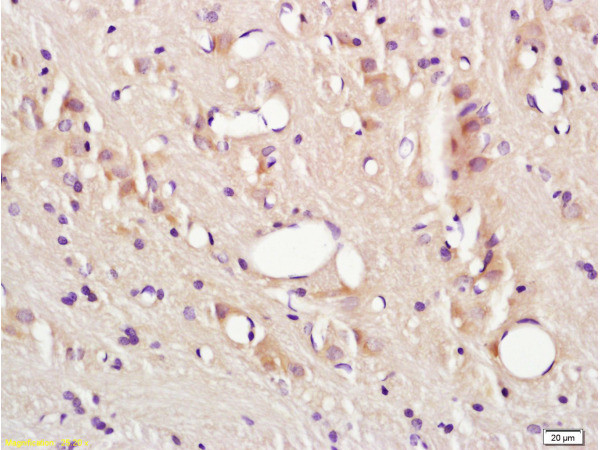 ICAM1 Antibody in Immunohistochemistry (Paraffin) (IHC (P))