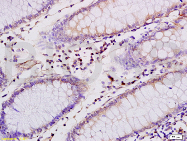 CD4 Antibody in Immunohistochemistry (Paraffin) (IHC (P))