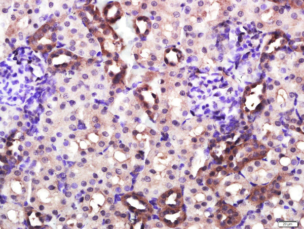 CD4 Antibody in Immunohistochemistry (Paraffin) (IHC (P))