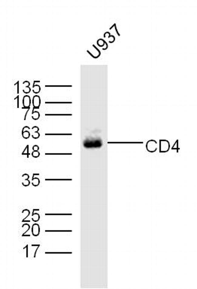 CD4 Antibody in Western Blot (WB)