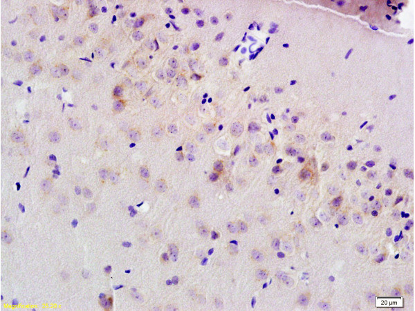 MRP1 Antibody in Immunohistochemistry (Paraffin) (IHC (P))