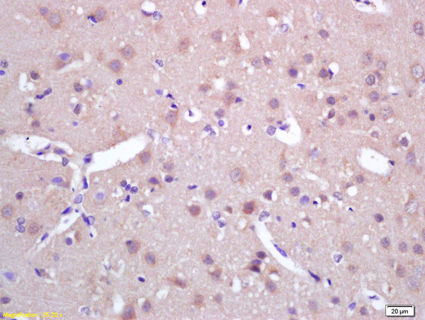 SPAG5 Antibody in Immunohistochemistry (Paraffin) (IHC (P))