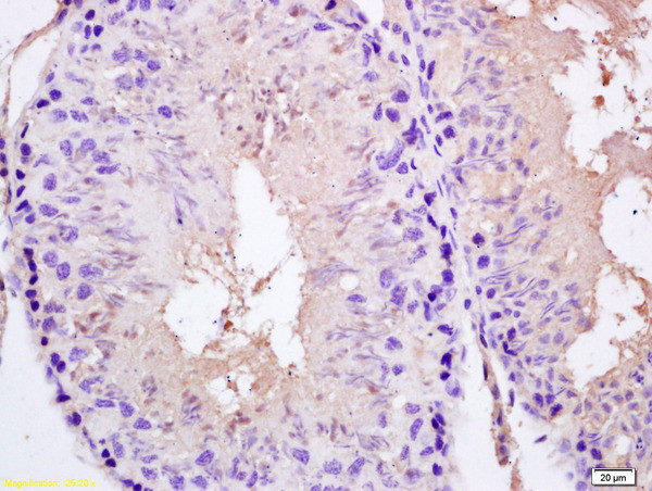 SPAG5 Antibody in Immunohistochemistry (Paraffin) (IHC (P))