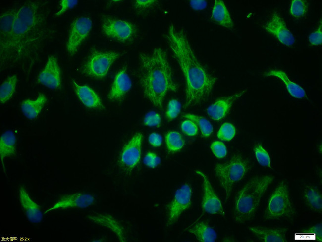 Vimentin Antibody in Immunocytochemistry (ICC/IF)