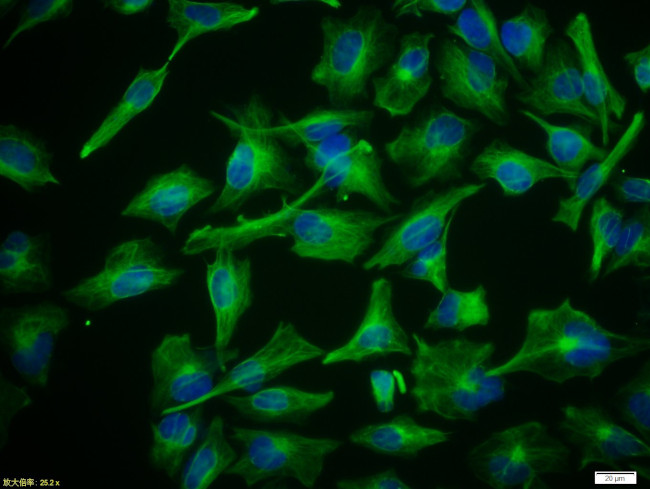 Vimentin Antibody in Immunocytochemistry (ICC/IF)