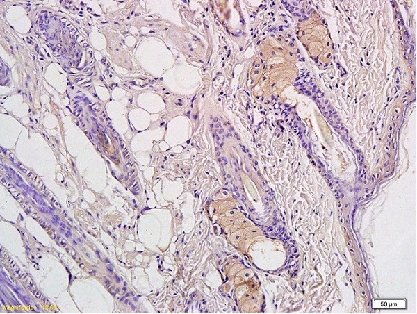 CD4 Antibody in Immunohistochemistry (Paraffin) (IHC (P))