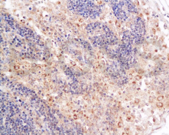 CD4 Antibody in Immunohistochemistry (Paraffin) (IHC (P))