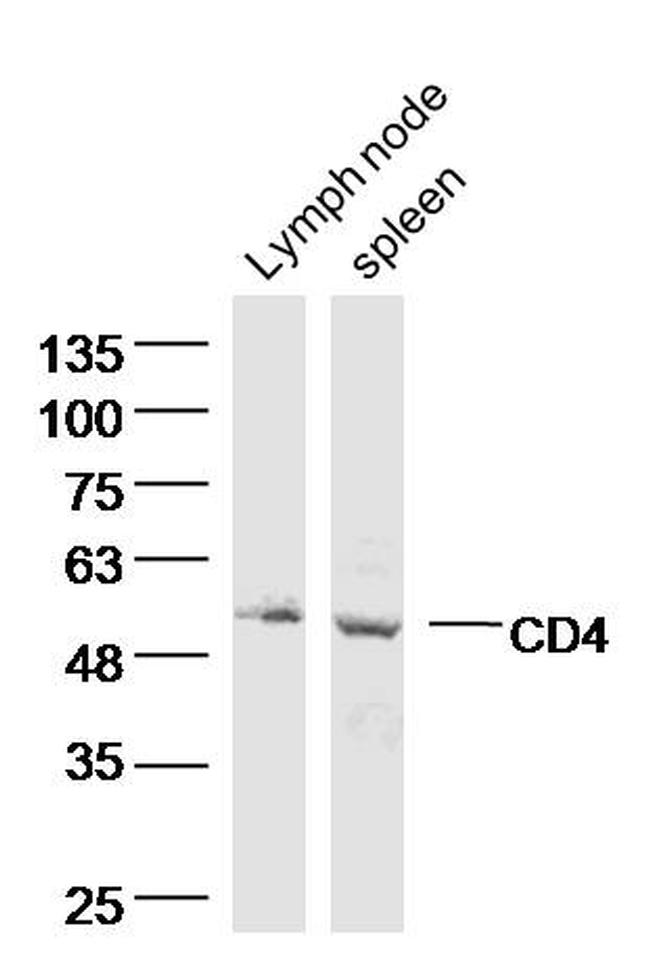 CD4 Antibody in Western Blot (WB)