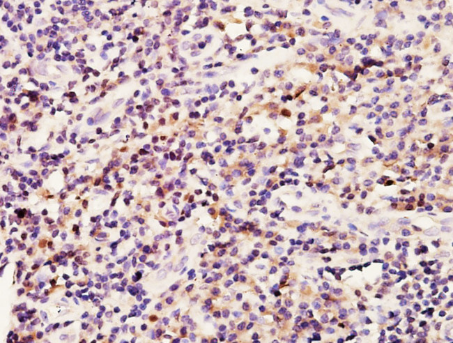 BRCA1 Antibody in Immunohistochemistry (Paraffin) (IHC (P))