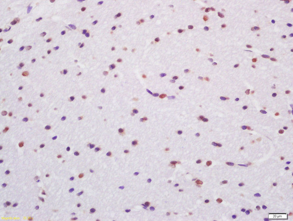 TARDBP Antibody in Immunohistochemistry (Paraffin) (IHC (P))