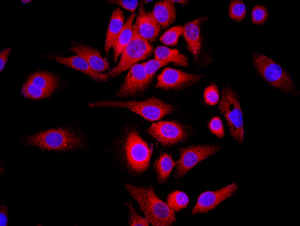 WDR26 Antibody in Immunocytochemistry (ICC/IF)