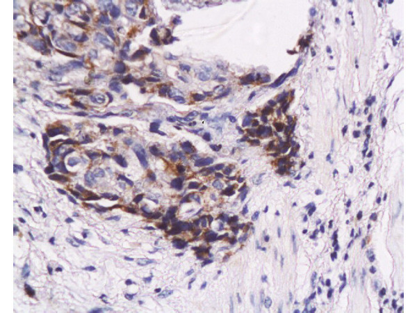 PAG608 Antibody in Immunohistochemistry (Paraffin) (IHC (P))